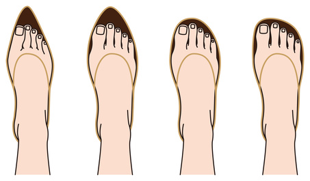 women's shoes for morton's toe