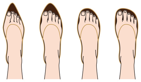 best trainers for morton's neuroma